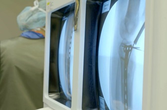 X-ray images on screens in OR
